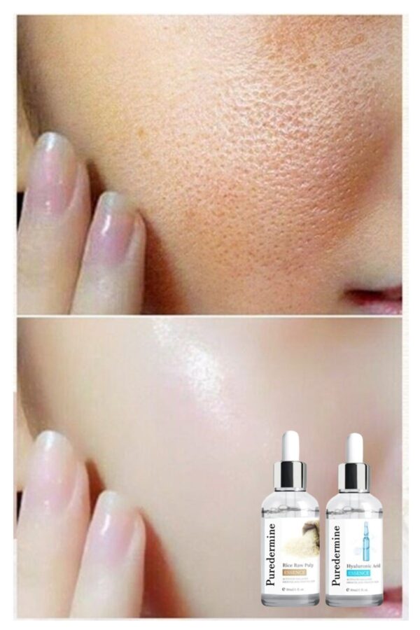 Puredermine Pirinç Serum Set & Rice Care Kit & Gözenek & Leke & Aydınlatıcı & Güzellik Ampulleri