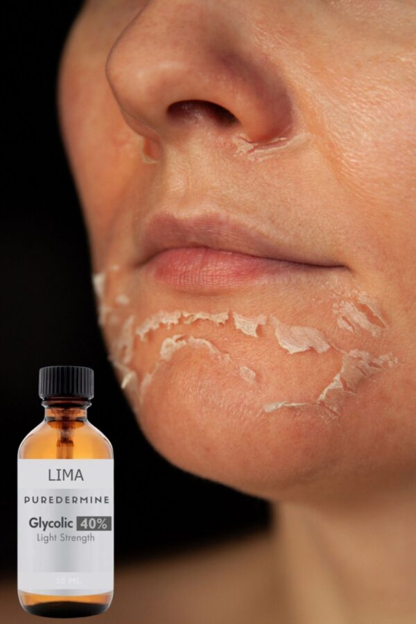 Puredermine Lima Kimyasal Peeling & Saf Glikolik Asit & % 40 Glikolik Asit & Cilt Soyma & Cilt Yenileme