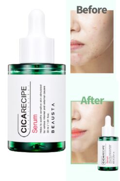 BEAUSTA Hassas Ciltler İçin Cica Centella İçeren Yatıştırıcı Akne Karşıtı Serum