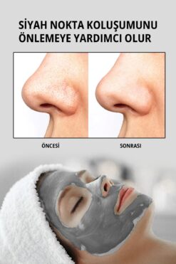 Setamell Kill Maskesi Kolejenli Siyah Nokta Karşıtı - Clay Collegen Mask