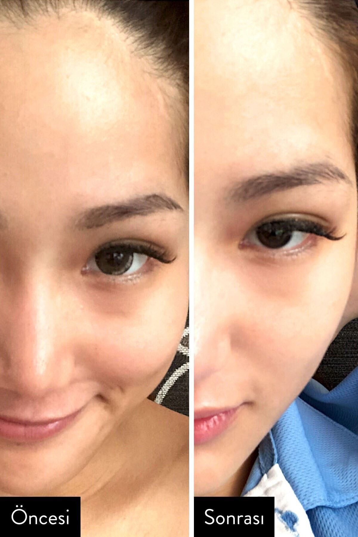 I'm From Rice Toner (YSKINZ) Arındırıcı Aydınlatıcı Pirinçli Tonik 150ml - Görsel 2