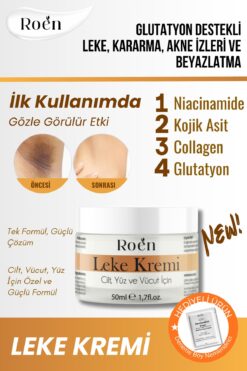 Roen Cilt Beyazlatıcı, Leke Kremi, Kararma, Akne, Güneş Lekeleri, Glutatyonlu Beyazlatıcı Leke Krem 50ml