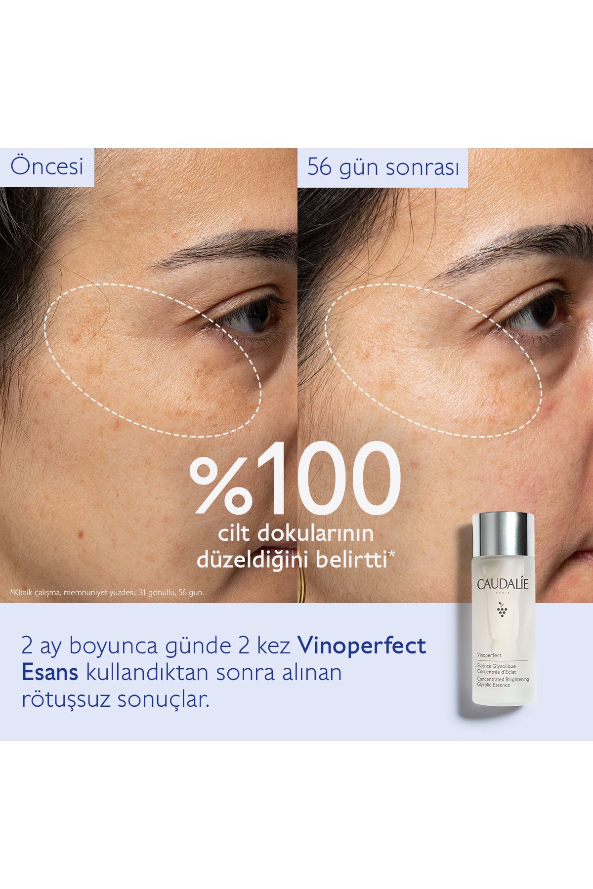Caudalie Vinoperfect Esans 100 ml - Görsel 2