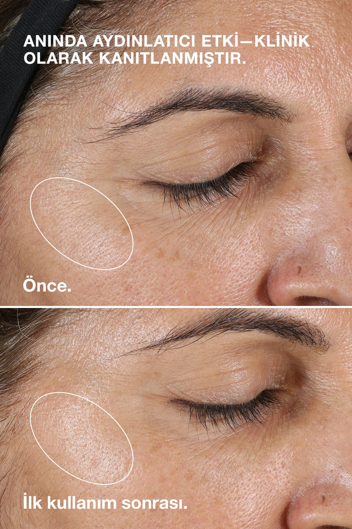 Clinique Clarifying Lotion (Tip 2) Kuru / Karma Ciltler İçin Arındırıcı Losyon / Tonik 200ml - Görsel 2