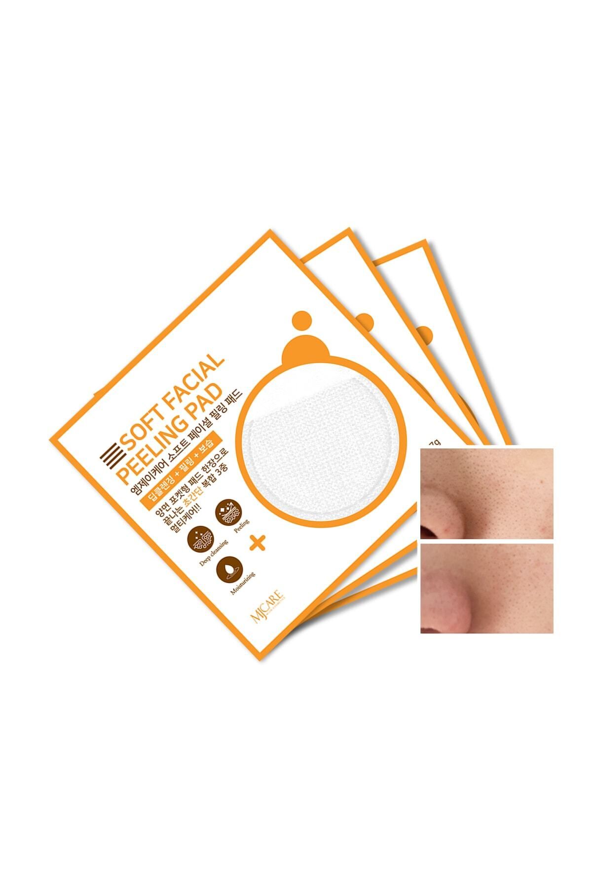 Mjcare Face Peeling Pad 3'lü
