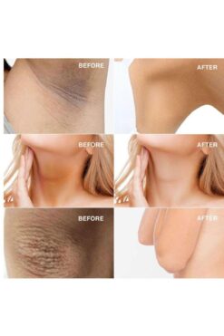 shop Kanza Beyazlatıcı Krem Sabun Ve Serum Seti 3'lü VİP Set