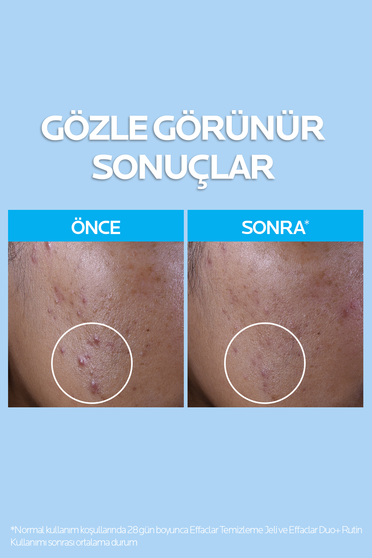 La Roche Posay Effaclar Yağlı ve Akneye Eğilimli Ciltler için Onarıcı Cilt Bakım Seti - Görsel 2
