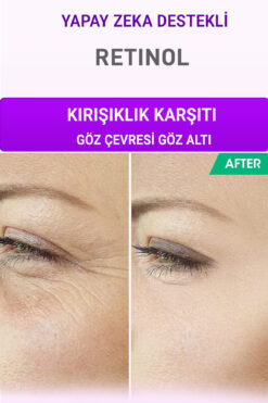 Devida Kırışıklık Karşıtı Serum Göz Çevresi ve Kaz Ayağı Alın Çizgileri Retinol Xella Series A220