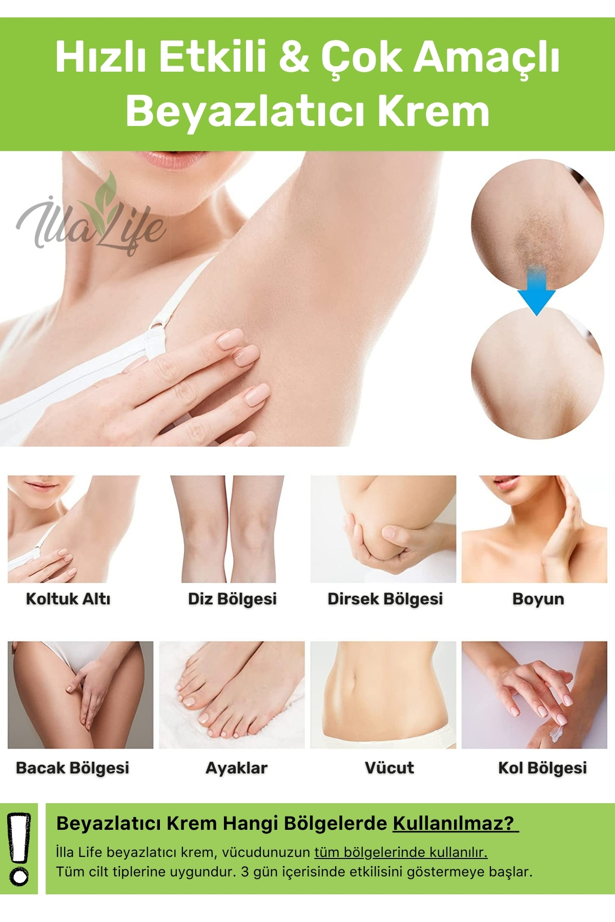 İlla Life Hızlı Etkili Kararma Karşıtı Cilt Beyazlatıcı Koltuk Altı Özel Bölge Bikini Bölgesi Beyazlatma Kremi - Görsel 2