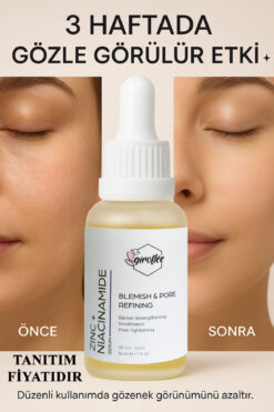 shop Zinc + Niacinamide Serum 30 ml – Gözenek Sıkılaştırıcı, ve Leke Karşıtı Serum