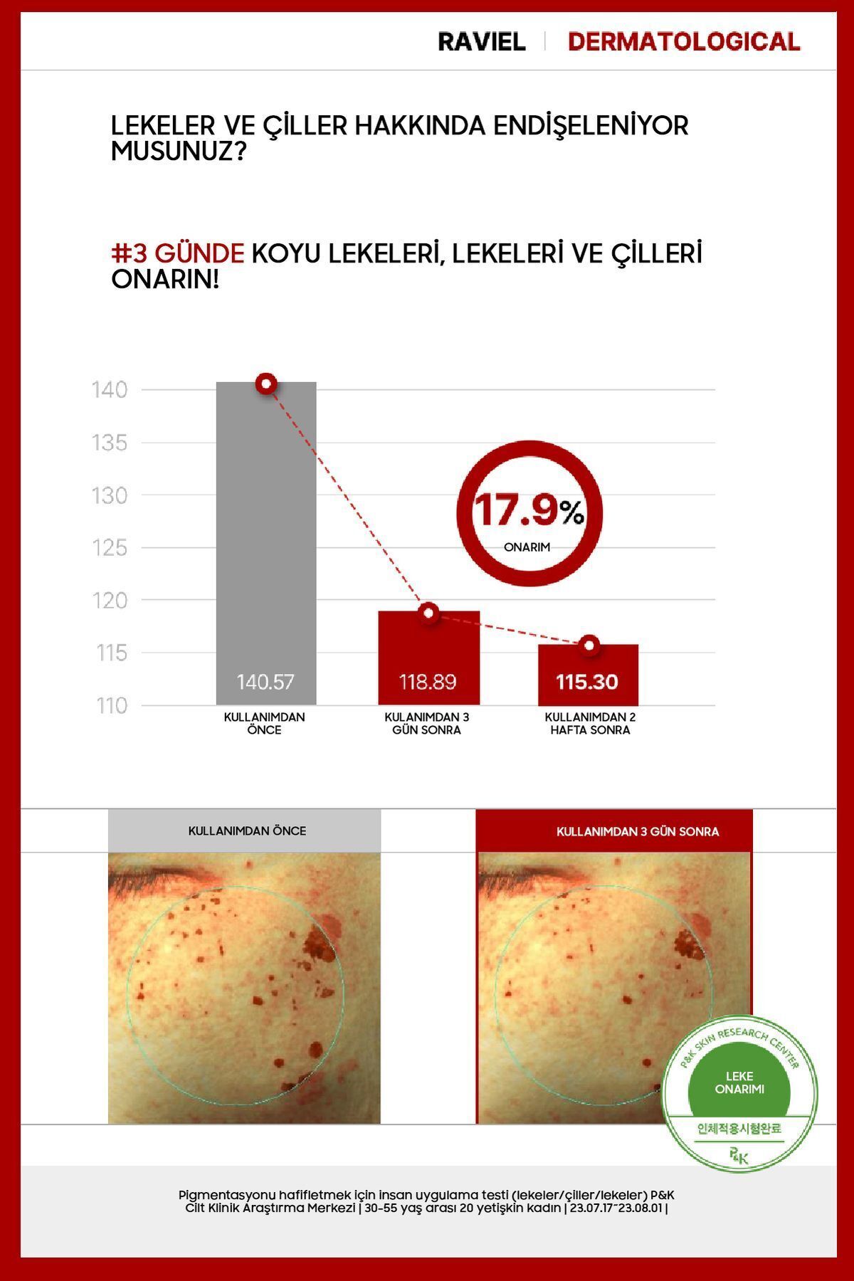 RAVİEL JUST ENOUGH Koyu Lekeler İçin Acerola Dark Spot Blemish Care Ampul Serum - Görsel 3
