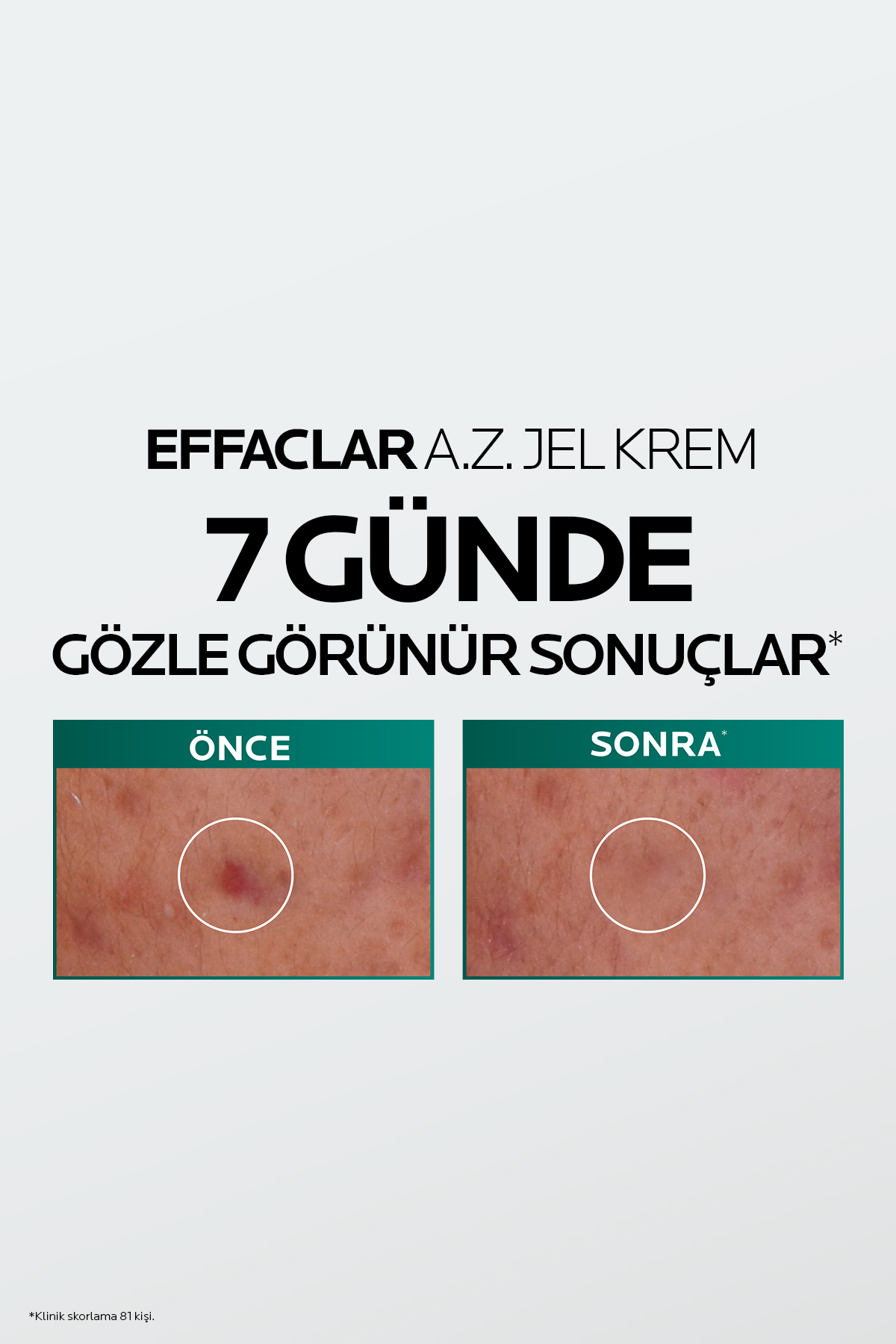 La Roche Posay Effaclar A.Z. Gel Krem 40 ml - Görsel 3