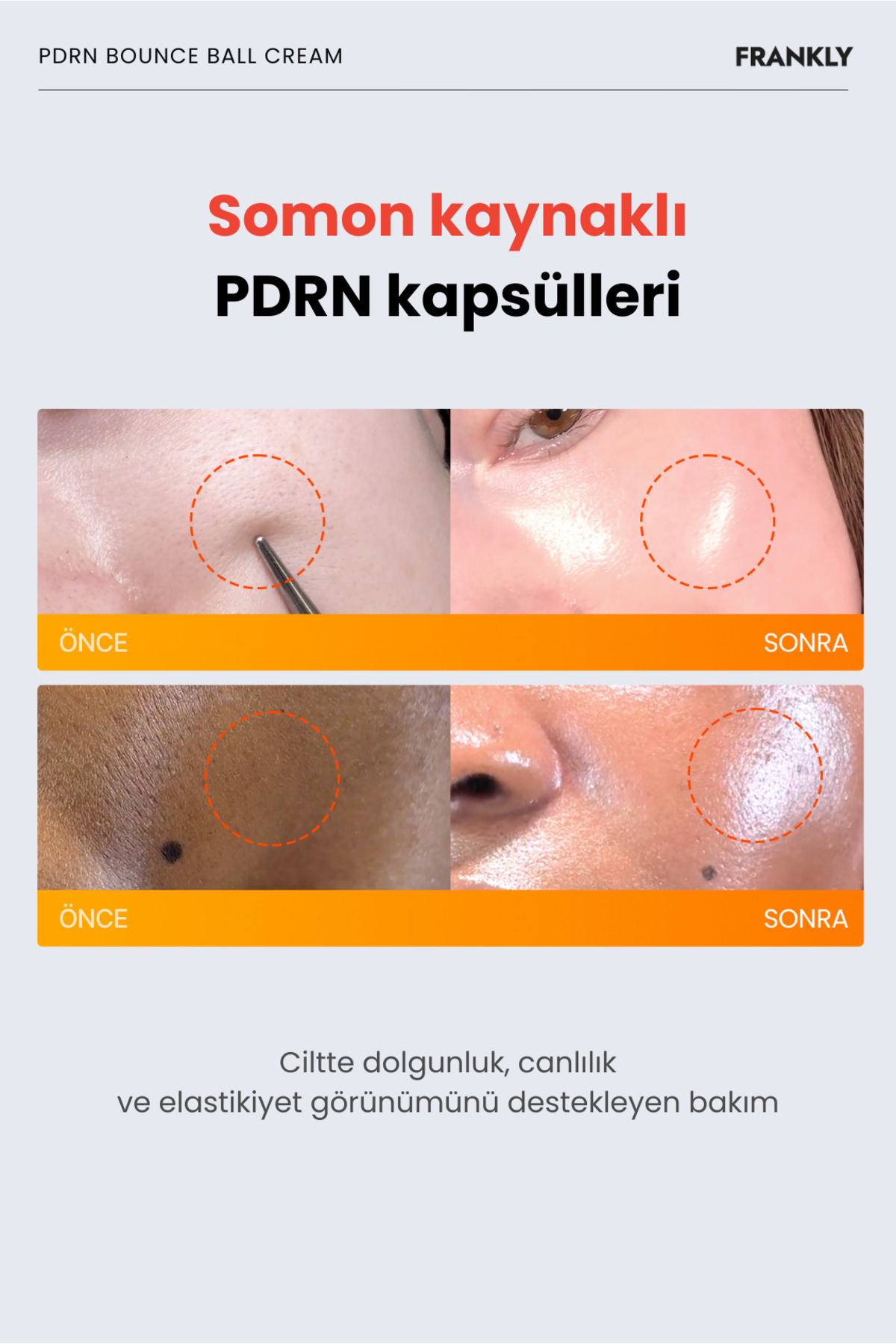 FRANKLY PDRN ve Somon DNA Kapsülleri İçeren Cildi Sıkılaştırmaya Yardımcı Yüz Kremi 50 mL - Görsel 2