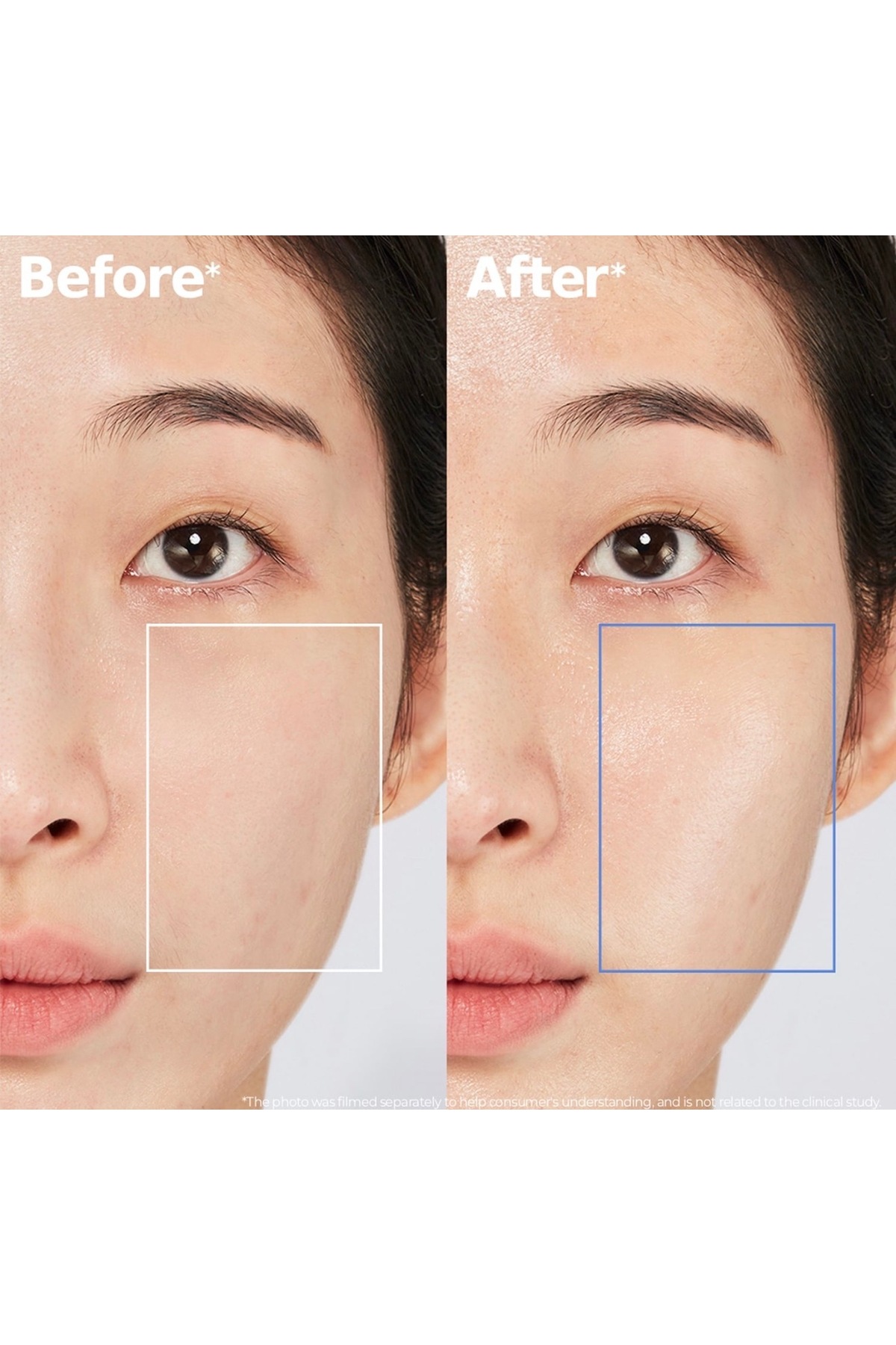 AESTURA ATOBARRIER365 Creme Nemlendirici Ve Cilt Bariyeri Güçlendirici Krem 45ml Elsbeauty - Görsel 2