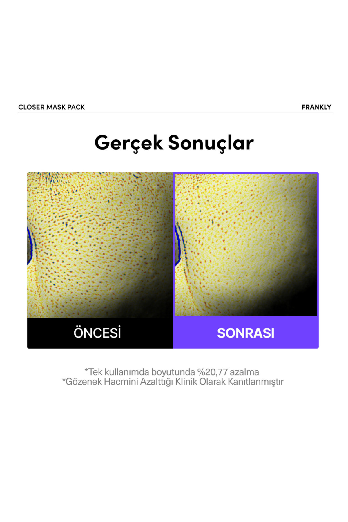 FRANKLY Pirinç Özü, Peptit ve Kolajen İçeren Gözenek Sıkılaştırıcı Kağıt Maske - Görsel 2