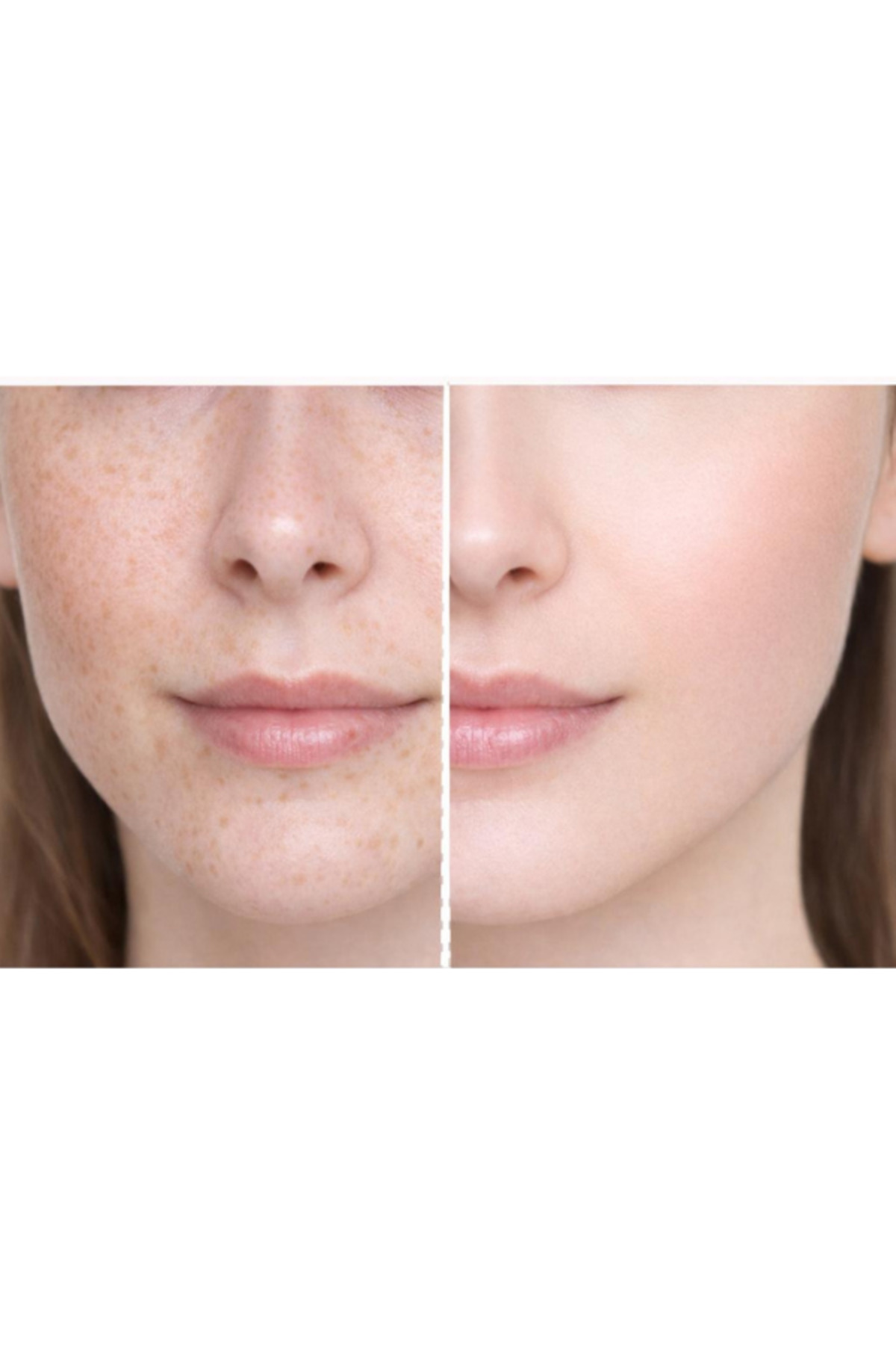 Lera The Natural Cilt Beyazlatıcı Aydınlatıcı Leke Karşıtı Krem 50 ml - Görsel 3