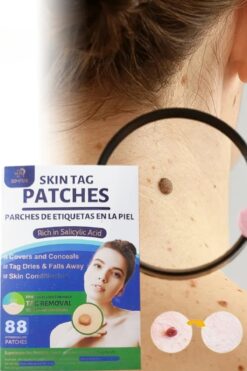 xolo Skin Tag Remover 88 Adet Leke Karşıtı Dökücü Yokedici Bant Sıgıl Et Beni Giderici