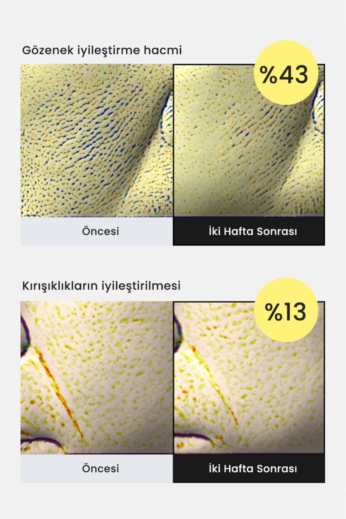 The Liva Retinal Shot & PDRN 400 Yüz Kremi Seti Sıkılaştırıcı Nemlendirici, yaşlanma ve kırışıklık karşıtı - Görsel 3