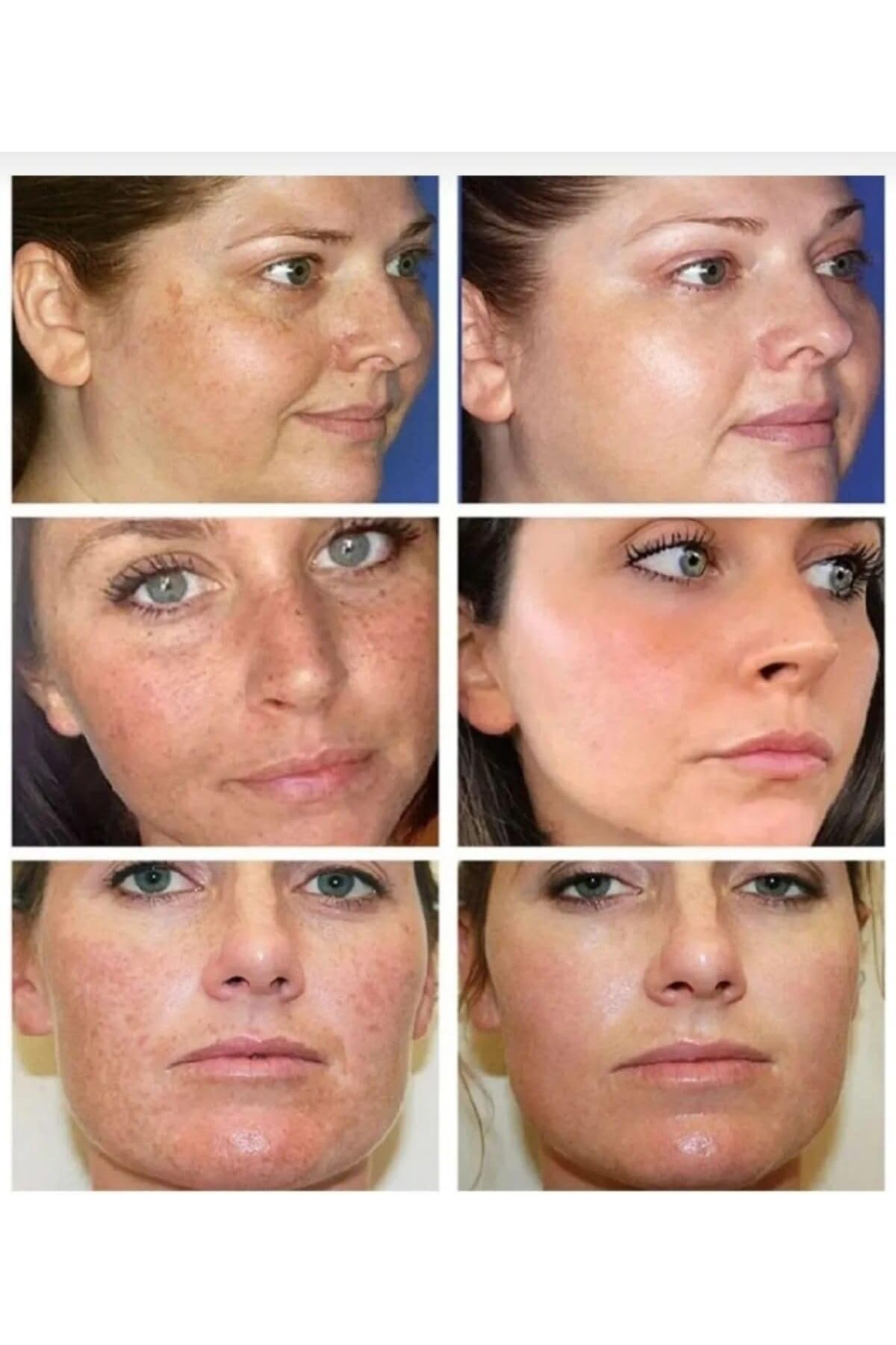 Kanza GÜZELİK KREMİ 3 LÜ SET - Görsel 3