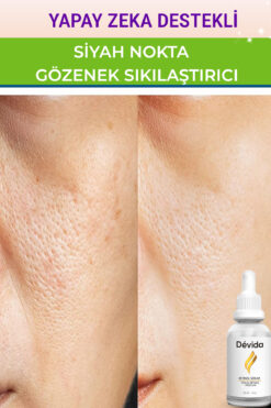 Devida Siyah Nokta Gözenek Sıkılaştırıcı Vivo Series A210