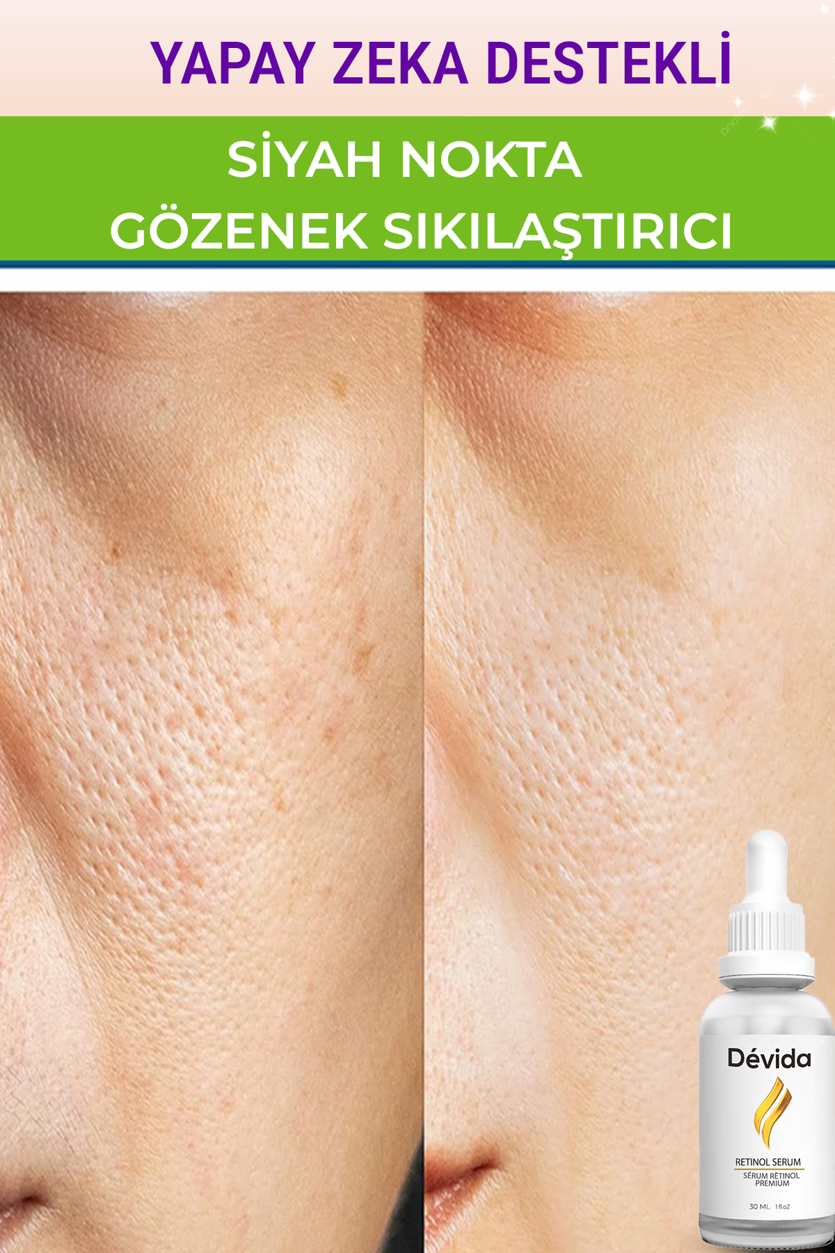 Devida Siyah Nokta Gözenek Sıkılaştırıcı Vivo Series A210