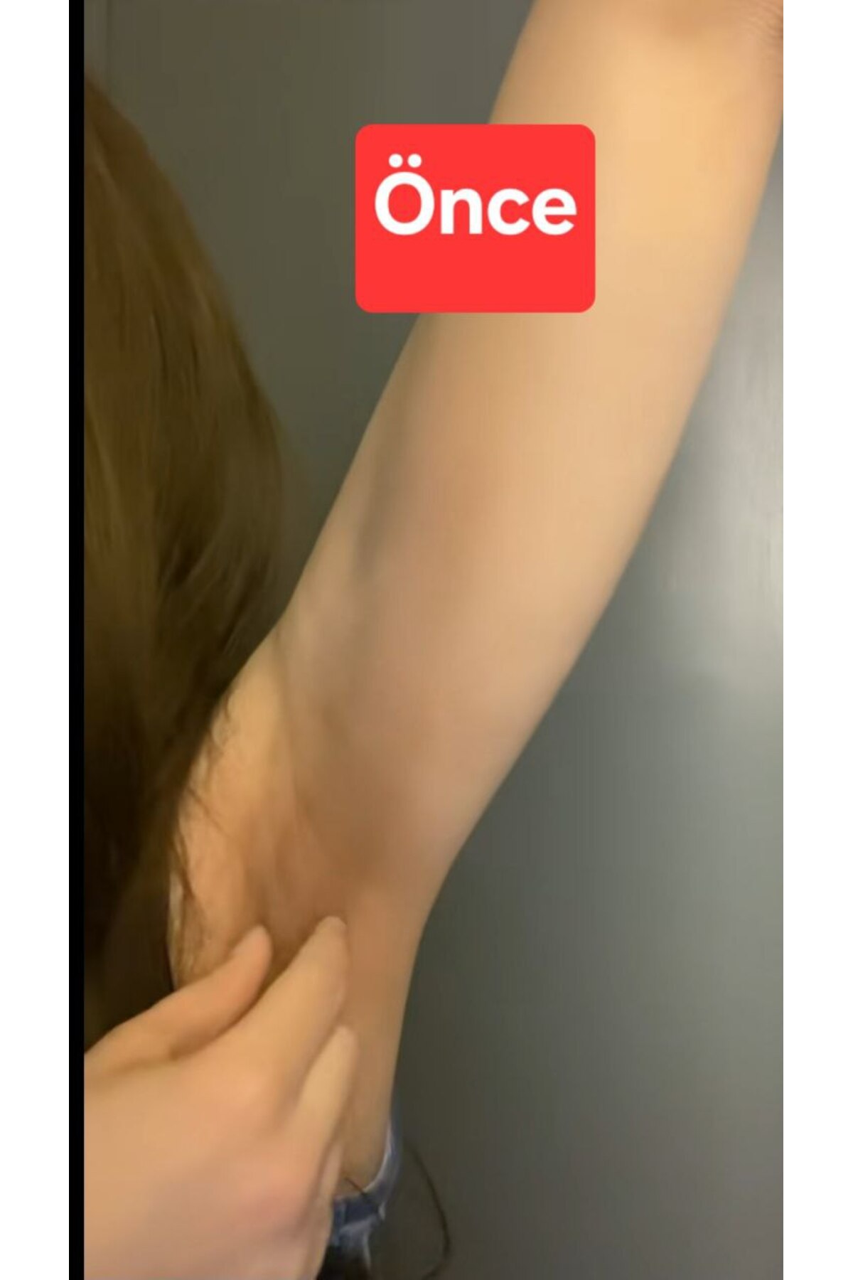 Kenta Beyazlatıcı Kenta Krem Cilt Yüz Koltuk Altı Bikini Bölgesi Dirsek Beyazlatma Özel Bölge Kararması - Görsel 2