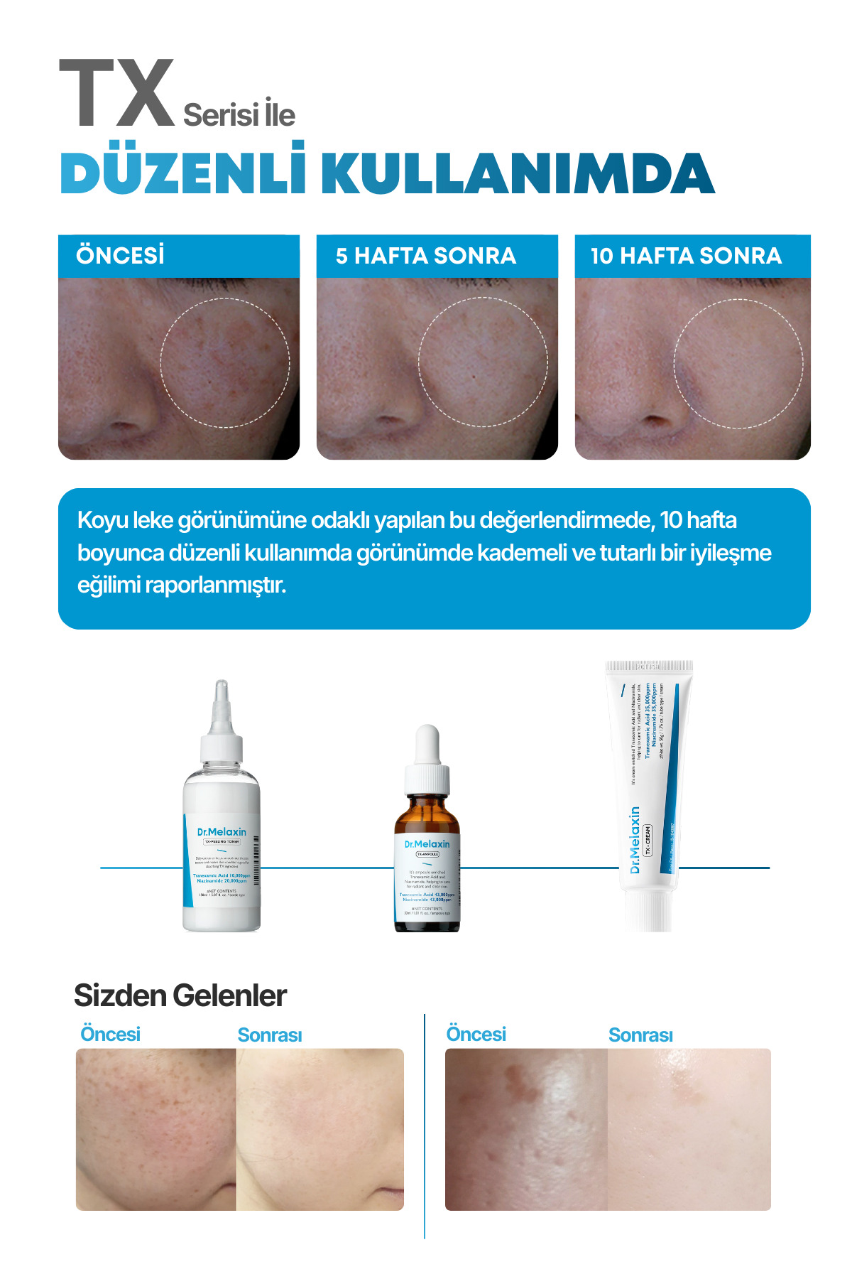 Dr.Melaxin Koyu Leke Karşıtı Aydınlatıcı Ampül – Traneksamik Asit Glutatyon Niasinamid Içerikli Tx-Ampül 30ml - Görsel 3