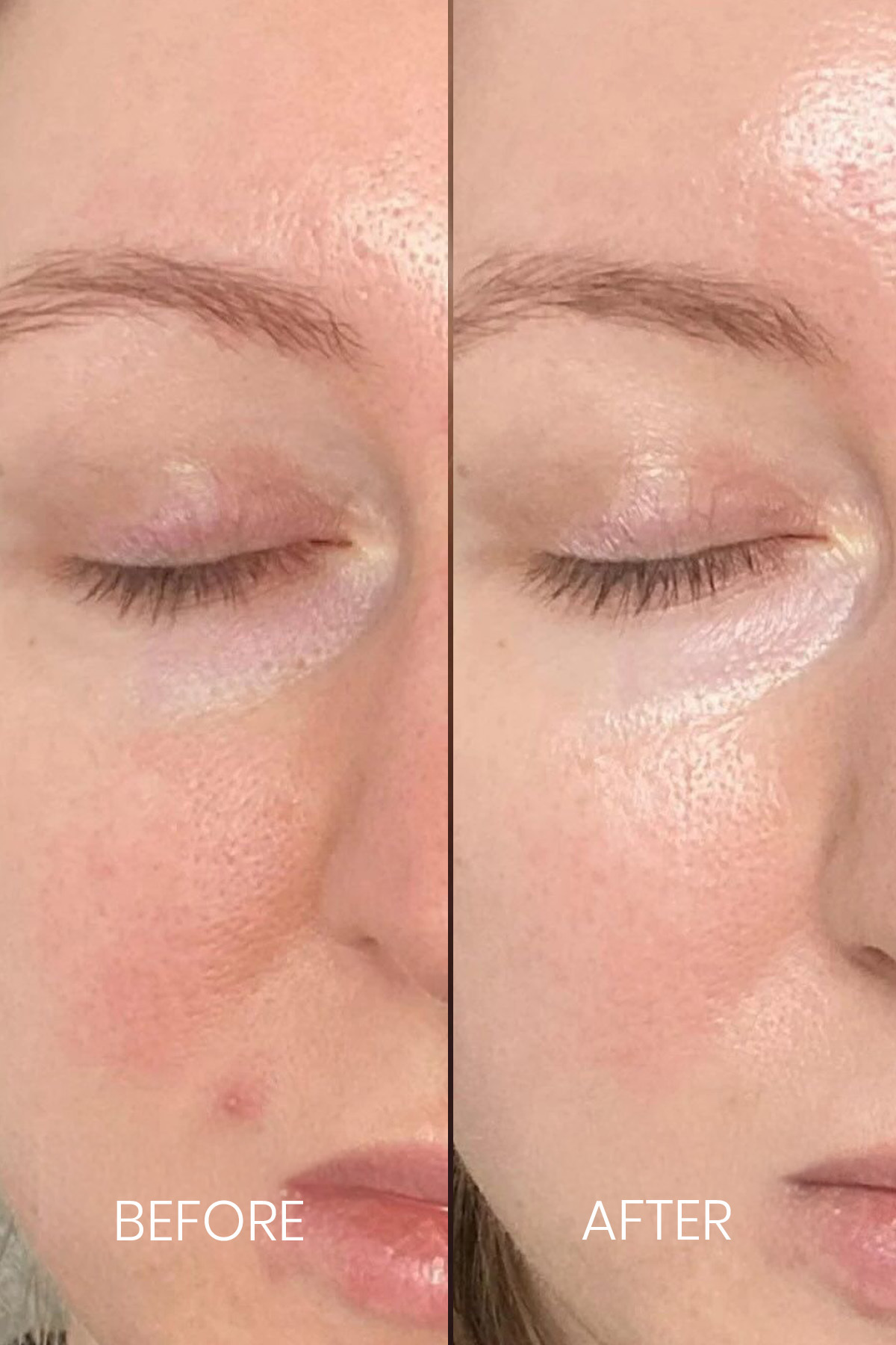 Jeuvenile Liposomal Vitamin C %17 Serum – Yoğun Aydınlatıcı & Canlandırıcı Etki - Görsel 3