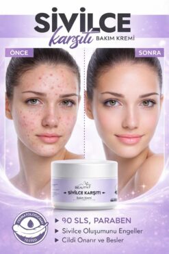 Miya Beauty Sivilce1 Önleyici Anti-blackheads Ve Siyah Nokta Karşıtı Leke.gideri Süper Krem