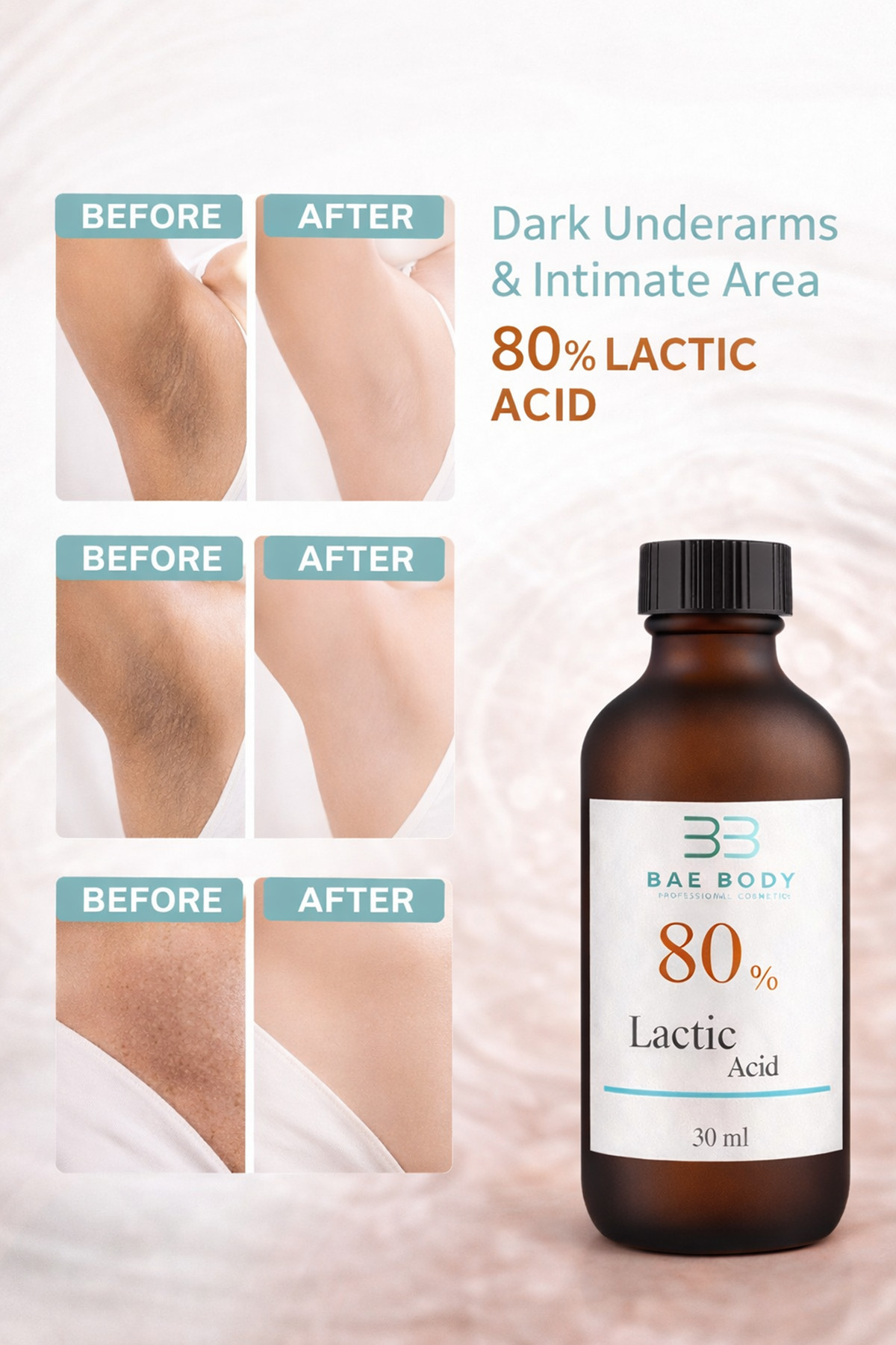 baebody %80 Lactic Acid – Güçlü Cilt Soyucu, Ölü Deri Arındırıcı ve Leke Karşıtı Peeling Serumu - Görsel 2