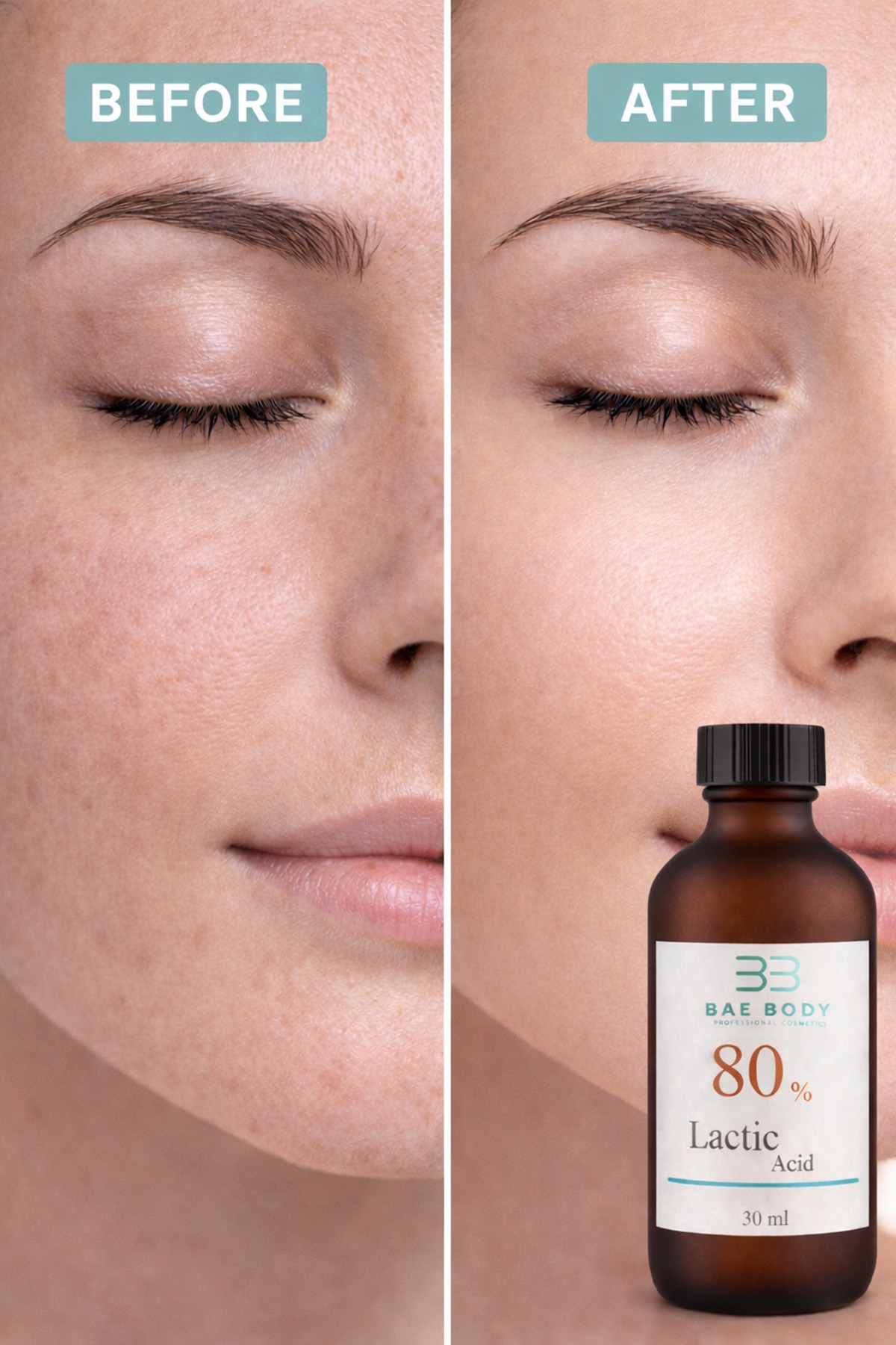 baebody %80 Lactic Acid – Güçlü Cilt Soyucu, Ölü Deri Arındırıcı ve Leke Karşıtı Peeling Serumu - Görsel 3