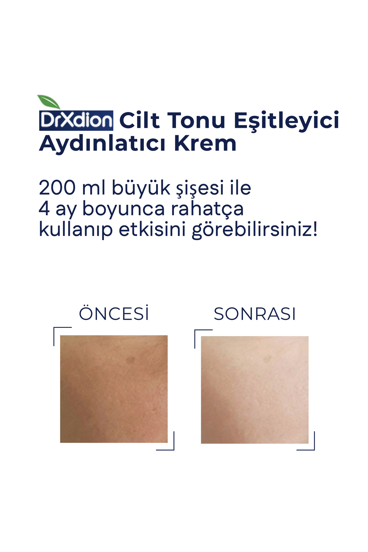 DrXdion Leke Karşıtı Aydınlatıcı Krem Niacinamide, Arbutin Vitamin C, Kojic Asit, Ferulic Asit (200 ml) - Görsel 2