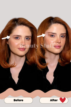 Lift Em Up Yüz & Göz Germe Bantları (60'lı Paket) (made In Usa)