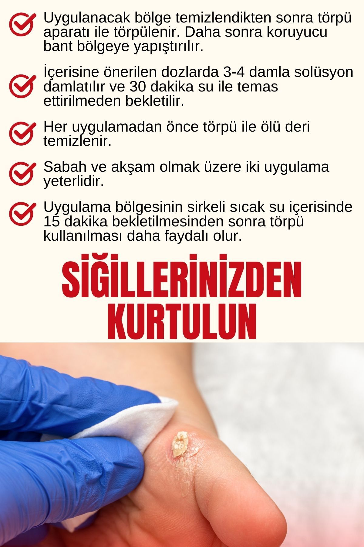 Siğilex Siğil Giderici Solüsyon, Siğil Sökücü - Görsel 3