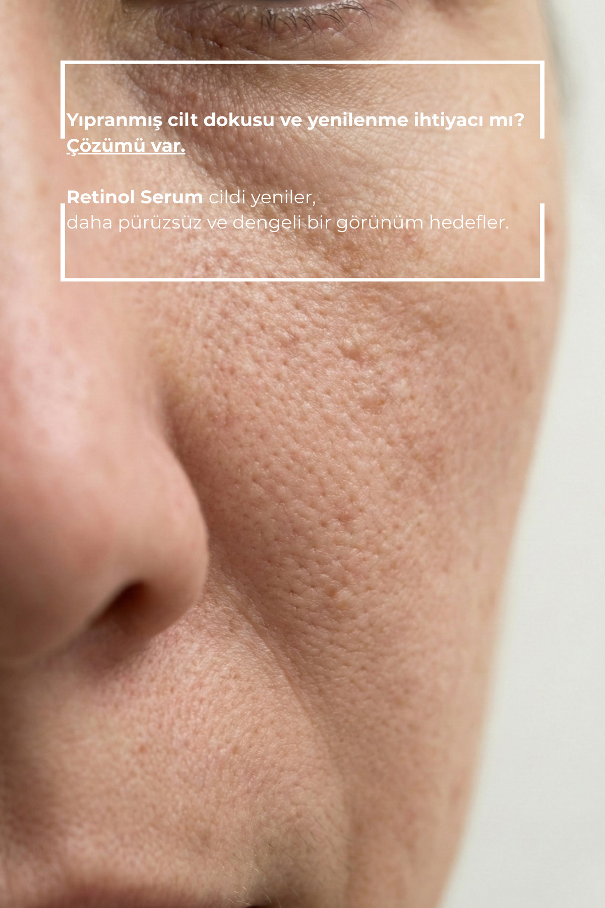 OMORFİA Yaşlanma Ve Kırışıklık Karşıtı Onarıcı Besleyici Retinol Cilt Bakım Serumu 30 ml - Görsel 2