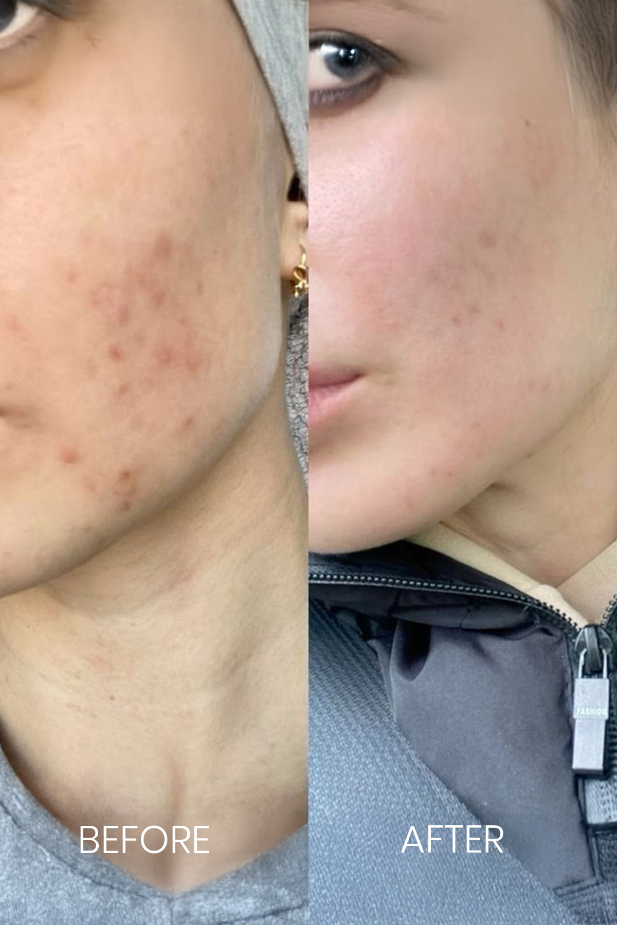 FaceLab Glikolik Asit %6 Tonik – Leke Karşıtı, Cilt Aydınlatıcı & Beyazlatıcı Bakım | 200ml - Görsel 3