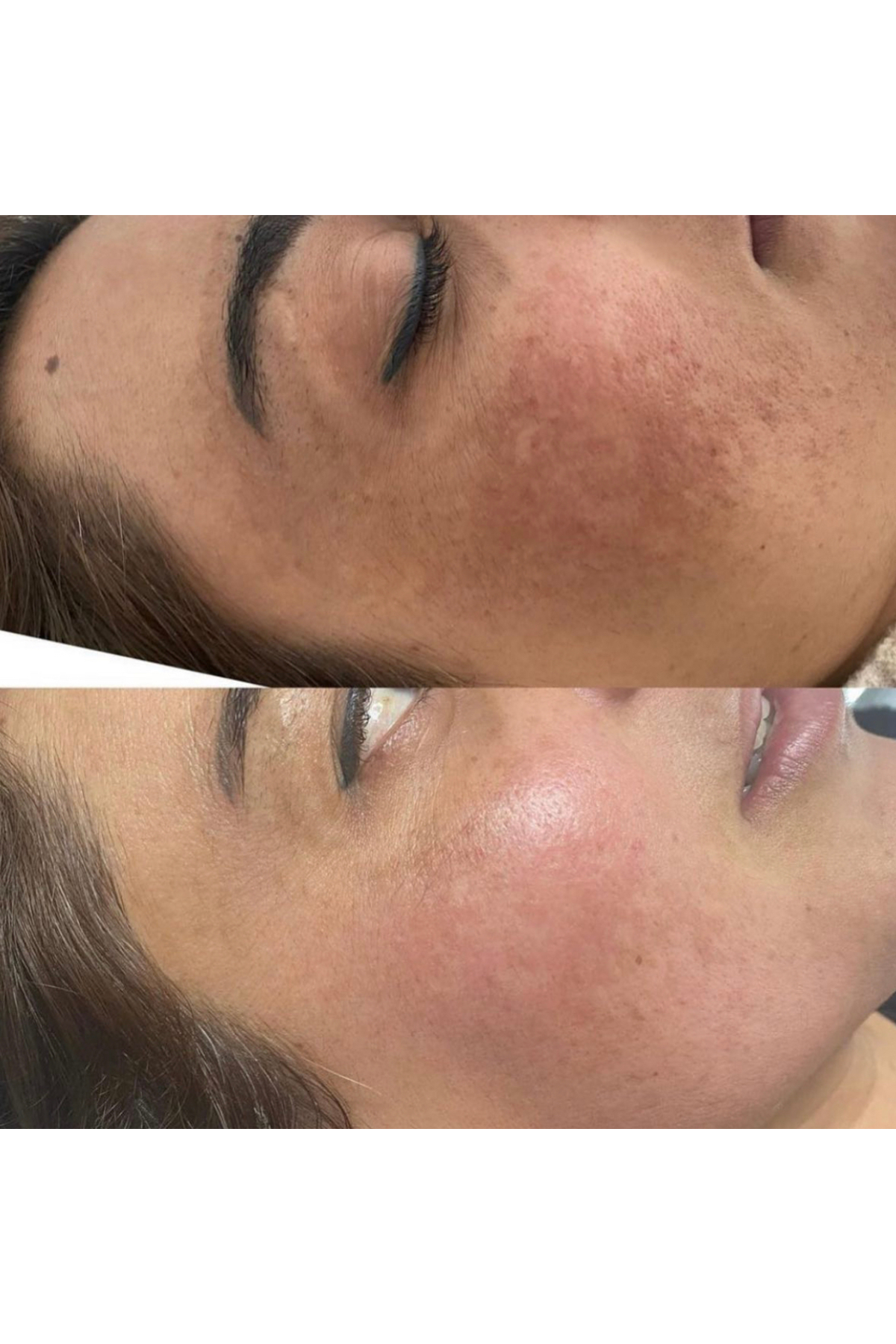 Egş DERMA delete DERMADELETE PEELİNG JEL(SOYUCU KREM) + Egş f120 GÜNEŞ KREMİ - Görsel 3