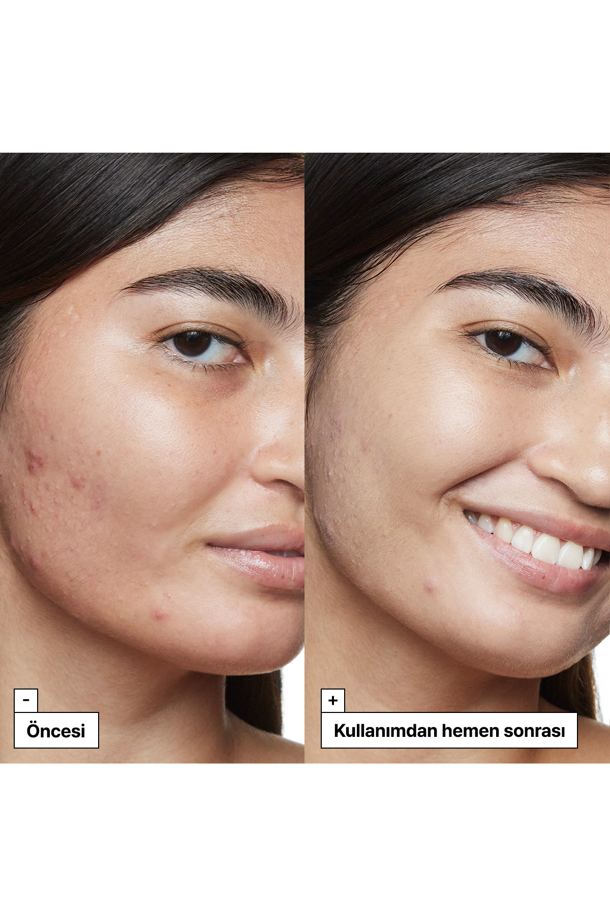 Dr.Jart+ Cicapair™ Kaplan Otu İçeren Kızarıklık Karşıtı Renk Eşitleyici Bakım Serumu SPF35 30ML - Görsel 3