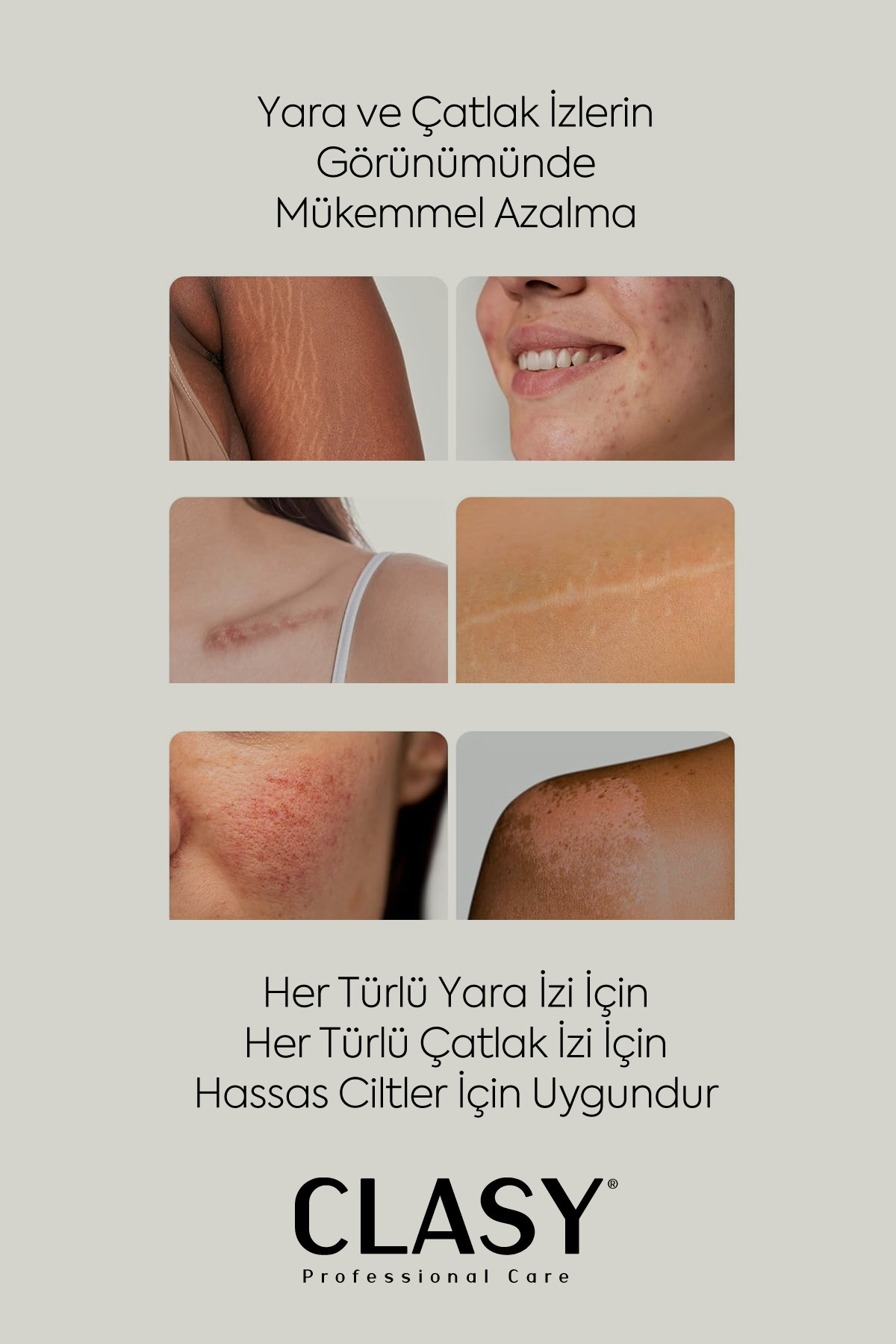 Clasy Care Yara Ve Çatlak Izleri Görünümünü Azaltıcı Ve Mükemmel Önleyici Krem (SCARS & STRETCH MARKS CREAM) - Görsel 3