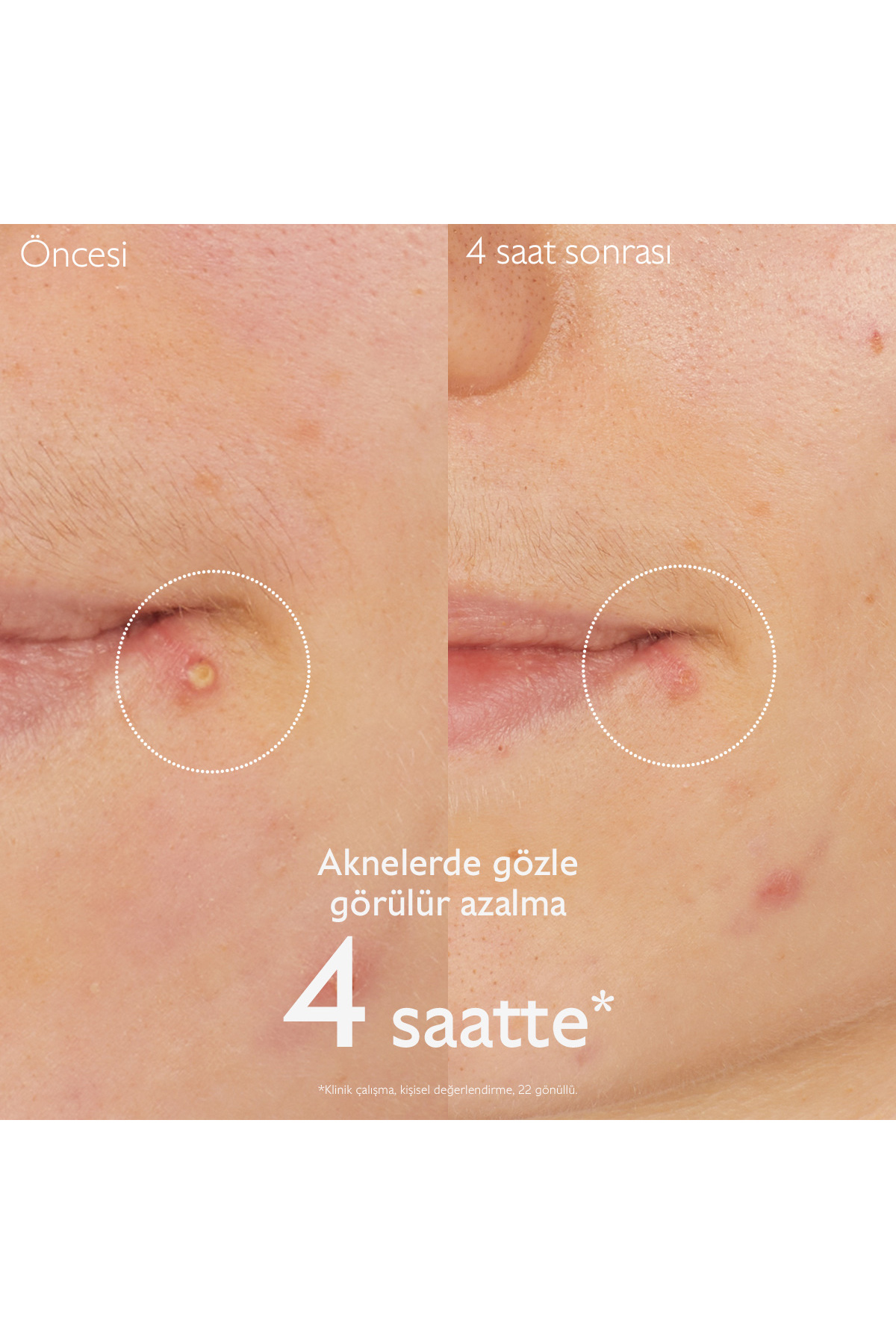 Caudalie Vinopure Akne Karşıtı Salisilik Spot Krem 15 ml - Görsel 3