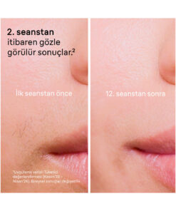 Braun IPL Silk·expert Pro 5, Evde Lazerle Tüy Alma, Mini Yüz Tüy Alma Cihazı, 2 Başlık, PL5146 - Görsel 3