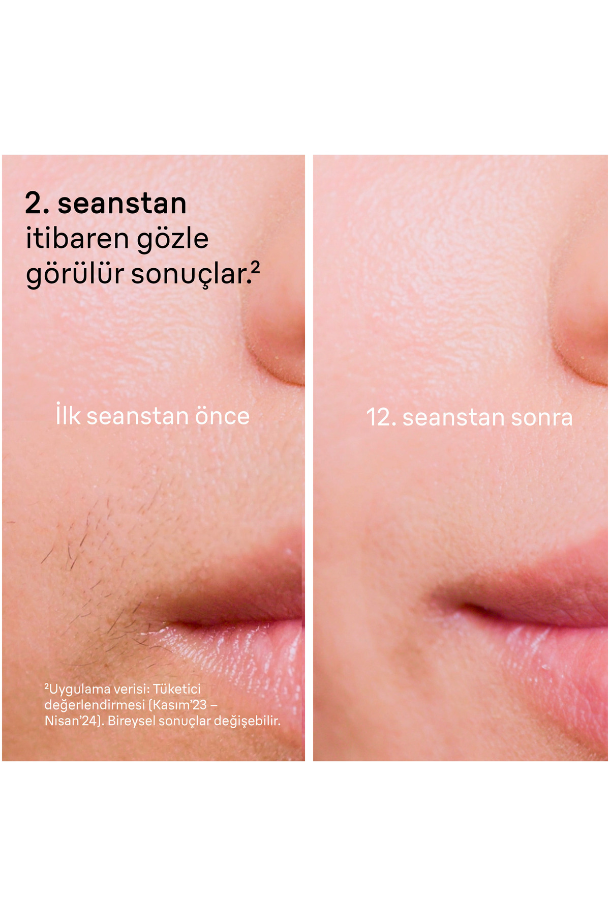 Braun IPL Silk·expert Pro 5, Evde Lazerle Tüy Alma, Mini Yüz Tüy Alma Cihazı, 2 Başlık, PL5146 - Görsel 3