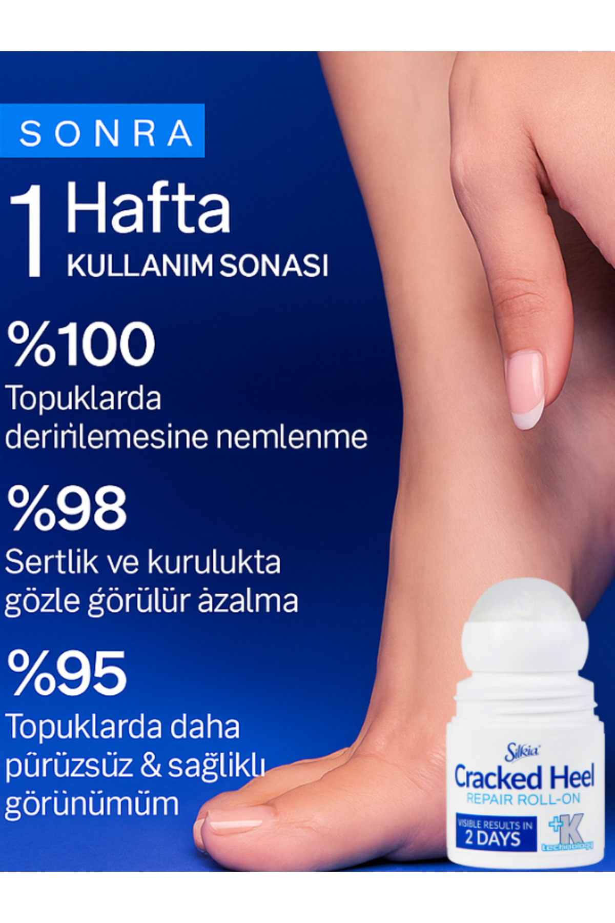 Silkia U.K Pedicare Çatlak Topuk Onarıcı Roll-On – 48 Saat Etkili Yoğun Bakım 50 ml - Görsel 3