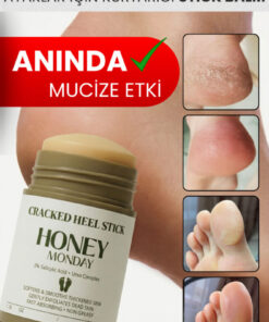HONEY MONDAY Ayak ve Topuk Çatlak Bakımı | Ayak Kokusu , Sertleşmiş Pürüzlü Topuklar için Kompleks Formül 35 gr
