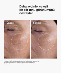 The Ordinary Glycolic Acid 7% Exfoliating Toner - Aydınlatmaya ve Pürüzsüzleştirmeye Yardımcı Tonik 240ml - Görsel 3