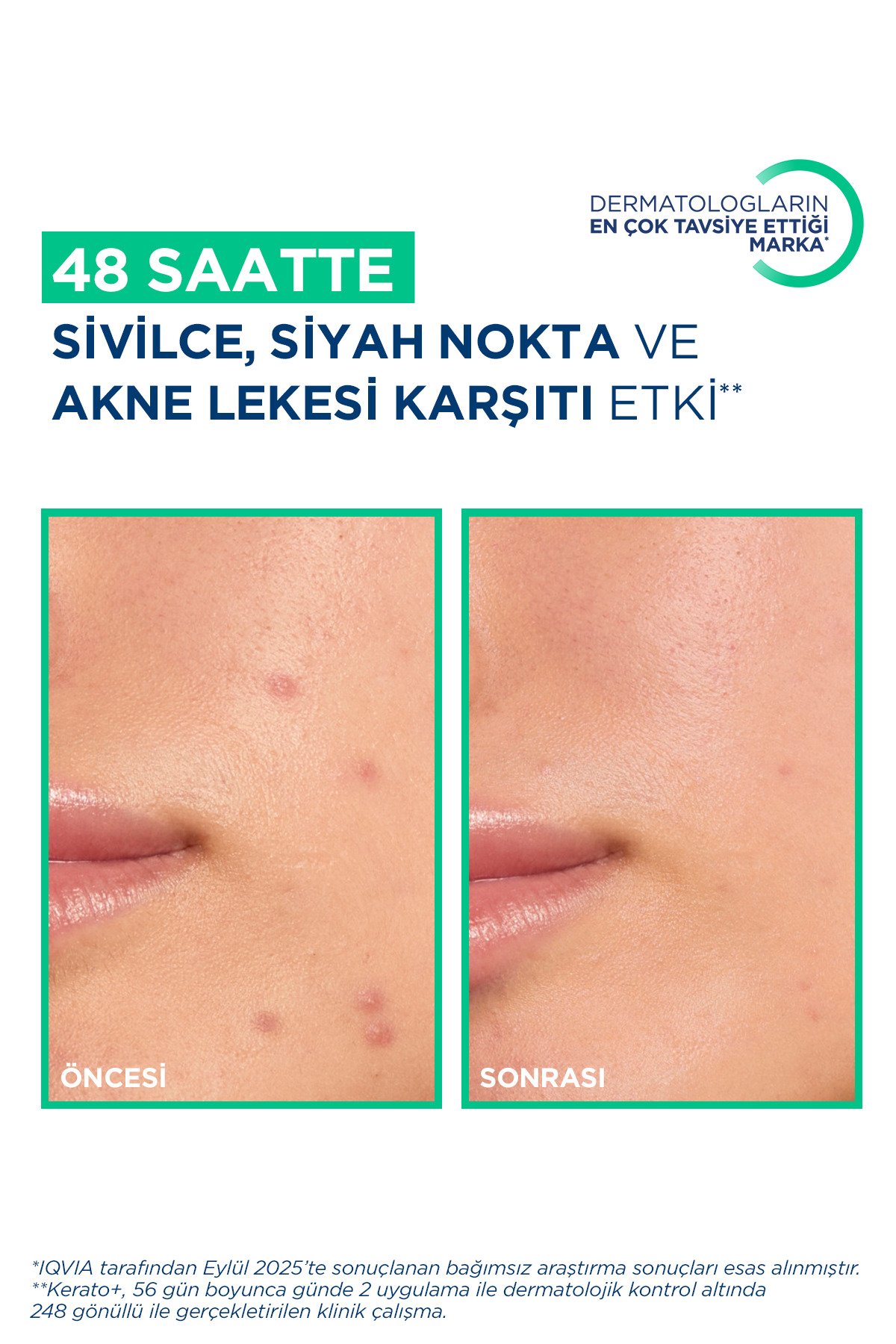 Bioderma Sebium Kerato+ Salisilik Asit İçeren Sivilce Akne Lekesi Siyah Nokta Karşıtı Nemlendirici Krem 30ml - Görsel 3