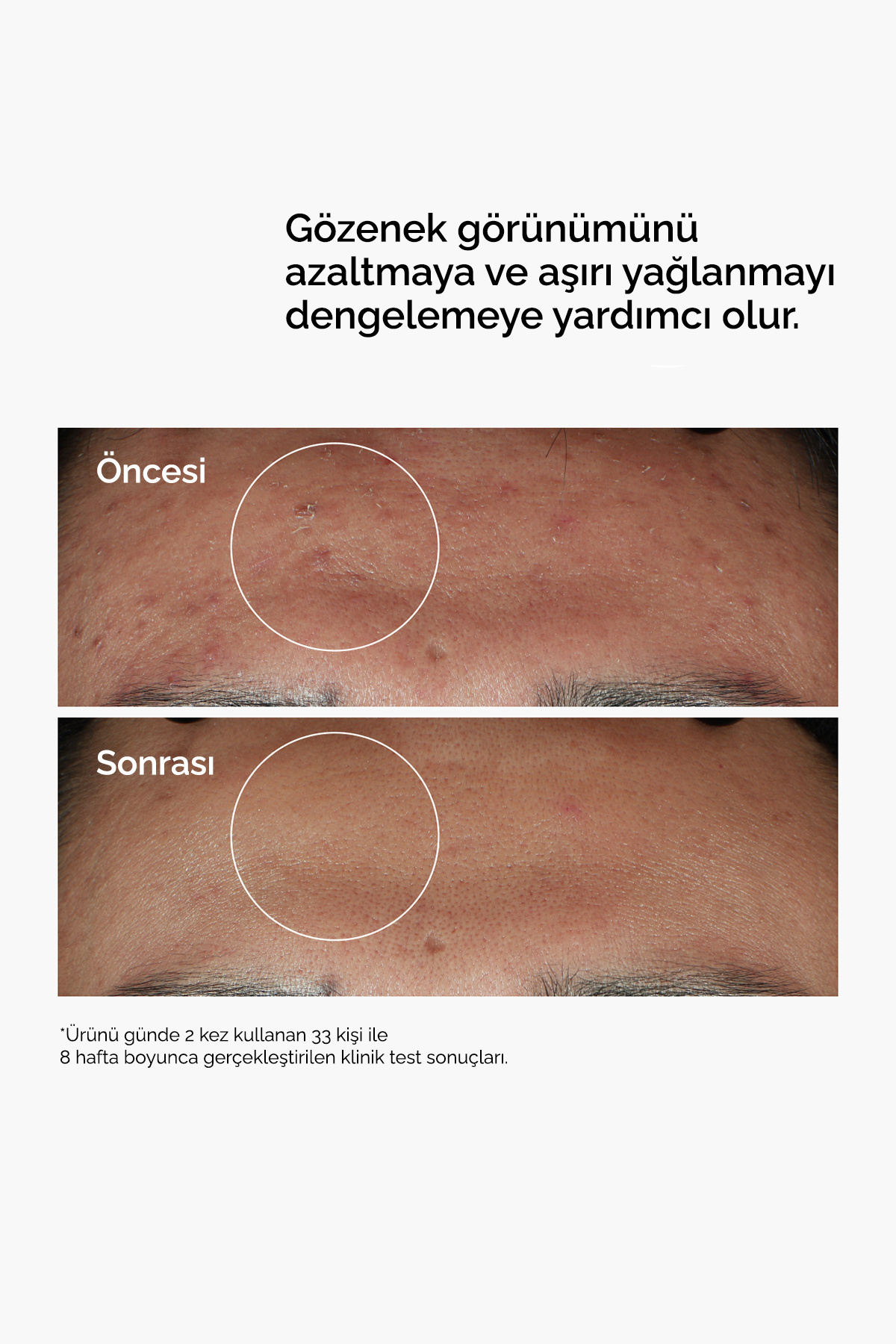 The Ordinary Niacinamide 10% + Zinc 1% - Leke ve Gözenek Görünümü Karşıtı Serum 60ml - Görsel 3