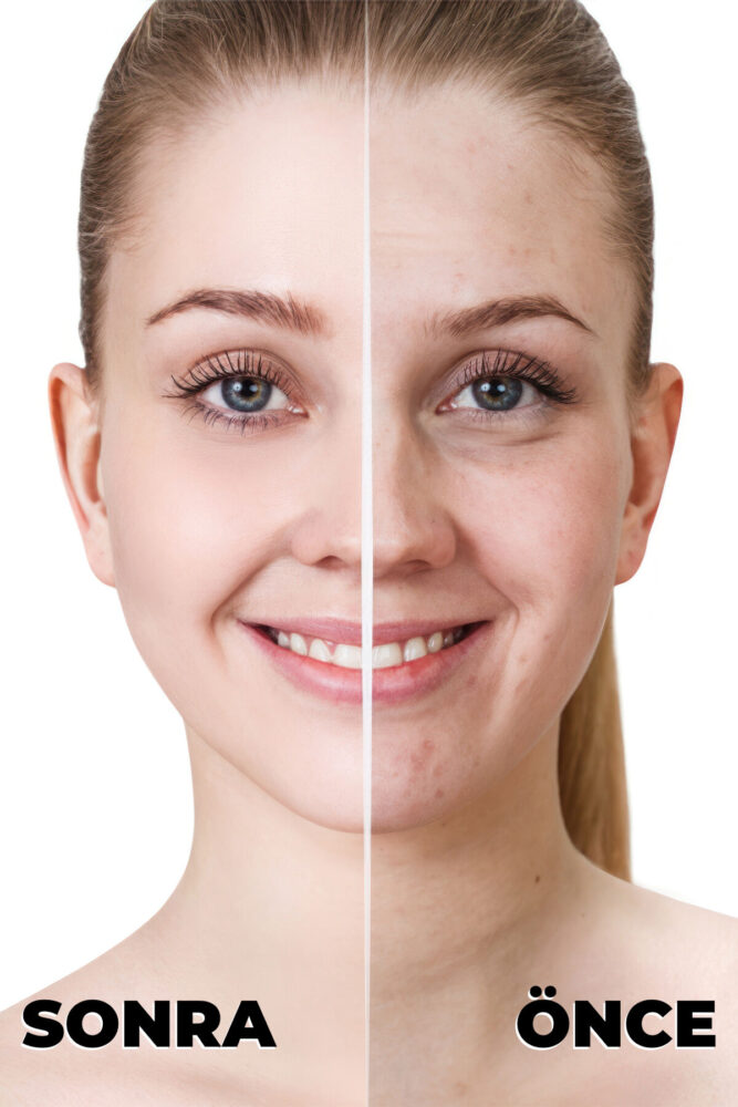 MUJGAN Derma Make-up Cover Tüp Kapatıcı No:1 - Görsel 3