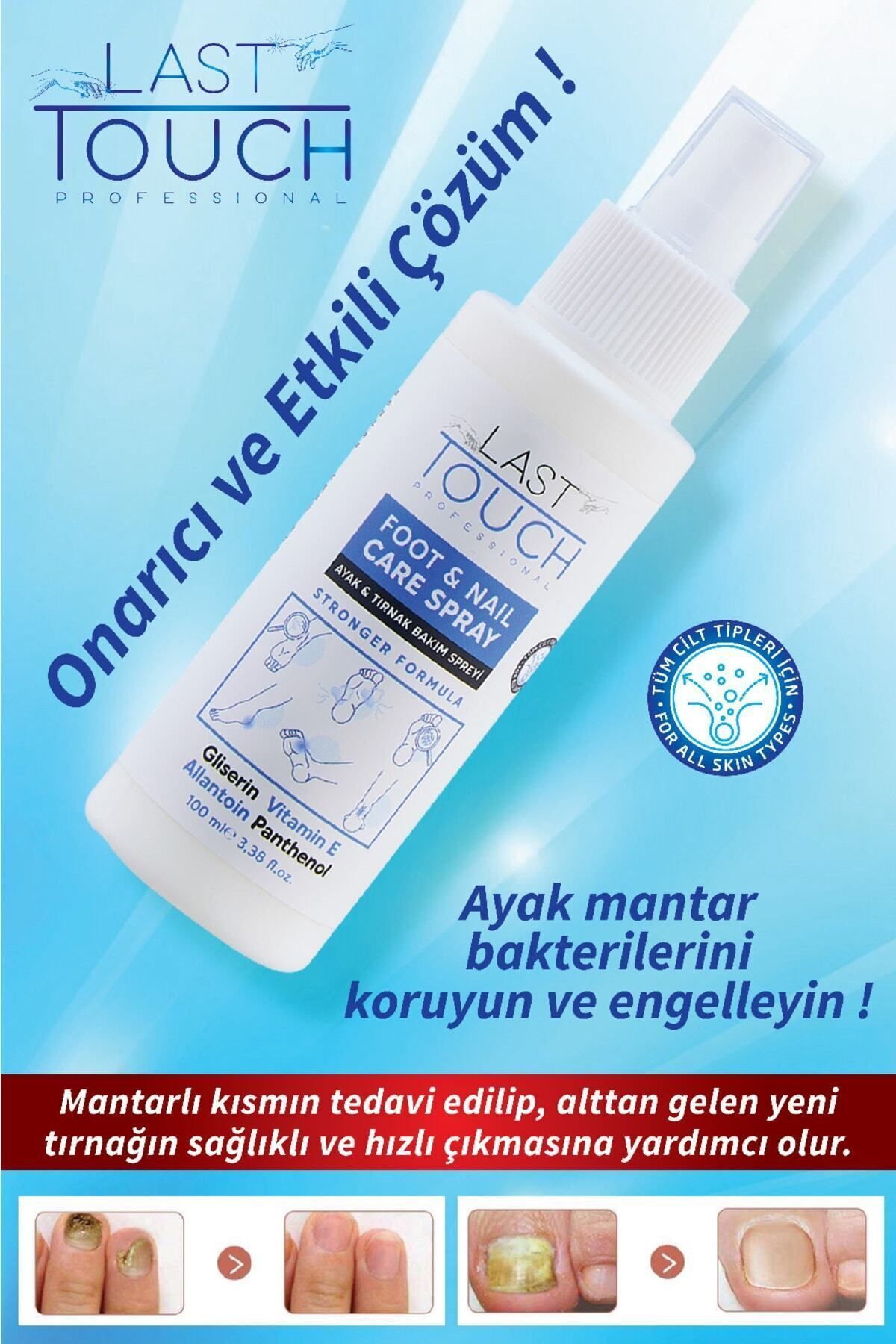 LAST TOUCH Ayak Ve Tırnak Mantar Spreyi, Kaşıntı, Koku Giderici Ve Nemlendirici Bakım Spreyi 100 Ml - Görsel 3