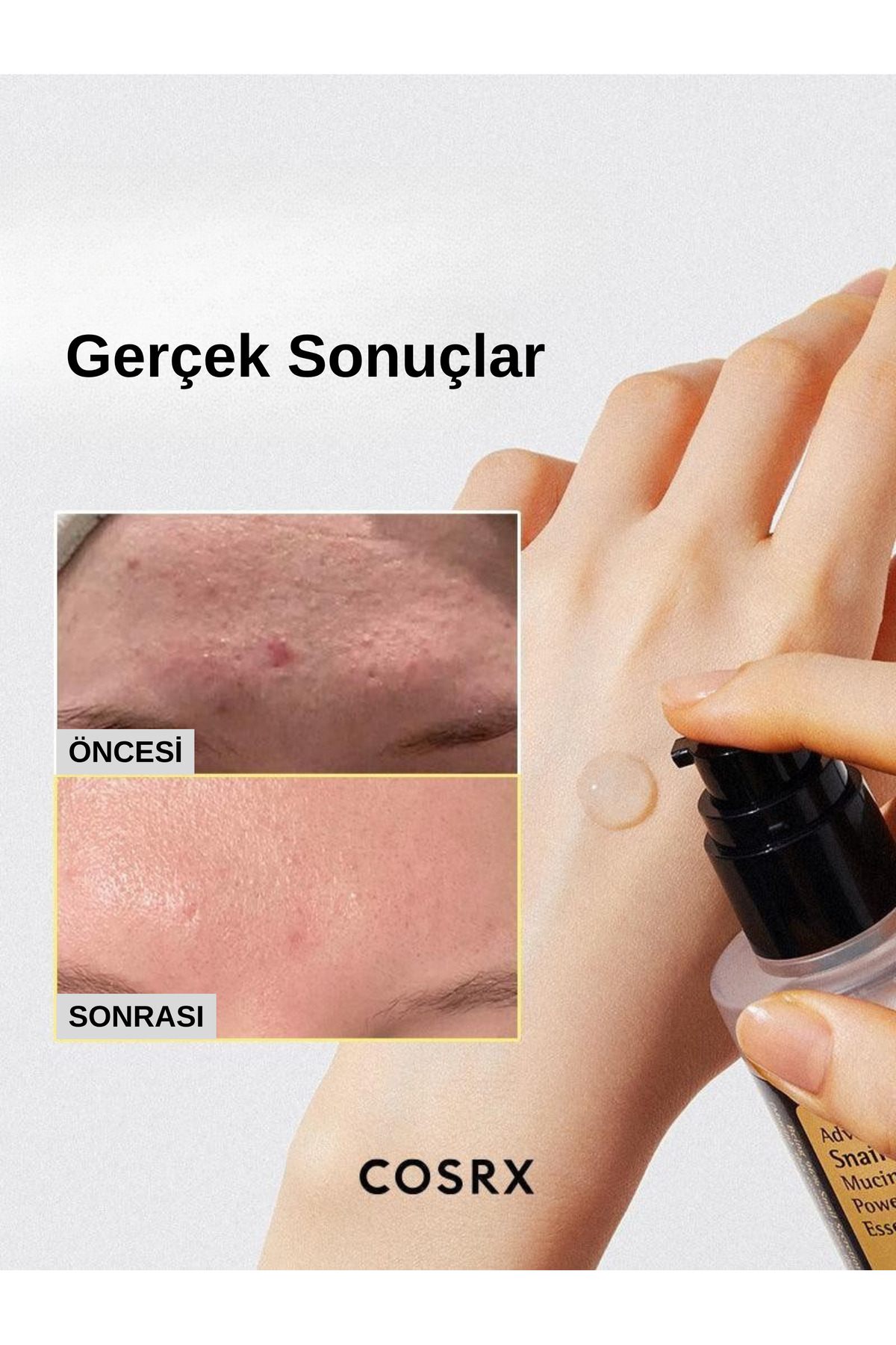 Cosrx Advanced Snail 96 Mucin Power Essence 100ml - Salyangoz Özlü Nemlendirici ve Besleyici Esans - Görsel 3